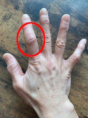 メノポハンドと漢方薬